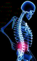 chiropractic, physical therapy, physiotherapy, Adolf and Kalkstein, low back pain, spine, rehabilitation
