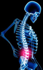 chiropractic, physical therapy, physiotherapy, Adolf and Kalkstein, low back pain, spine, rehabilitation