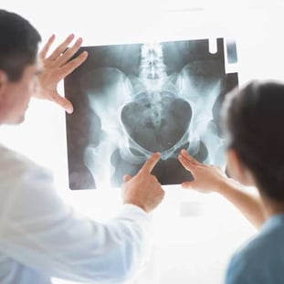 Nurse and doctor examining x-ray of a hip joint and pelvis