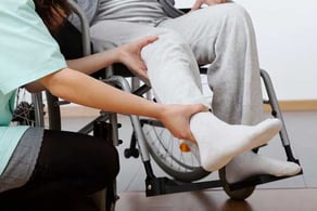 Young physical therapist stretching a leg after a femur fractured person
