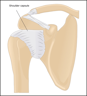 Picture of a shoulder joint capsule with instability