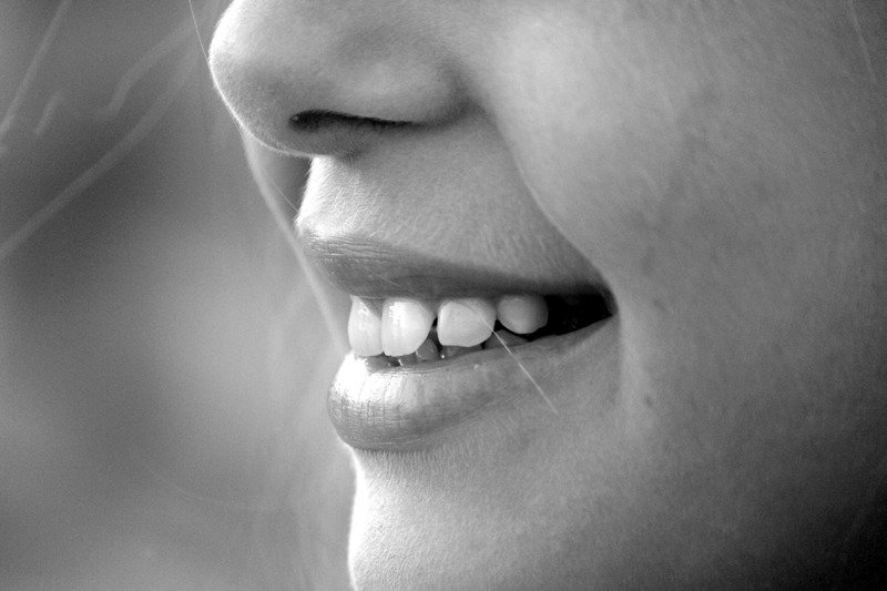 A smile with a health TMJ joint A smile with a health TMJ joint